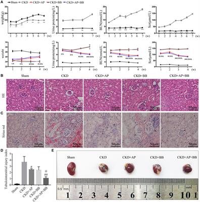 Astragalus mongholicus Bunge and Panax Notoginseng Formula (A&P) Combined With Bifidobacterium Contribute a Renoprotective Effect in Chronic Kidney Disease Through Inhibiting Macrophage Inflammatory Response in Kidney and Intestine